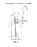 TRANS-CATHETER VENTRICULAR RECONSTRUCTION STRUCTURES, METHODS, AND SYSTEMS     FOR TREATMENT OF CONGESTIVE HEART FAILURE AND OTHER CONDITIONS diagram and image