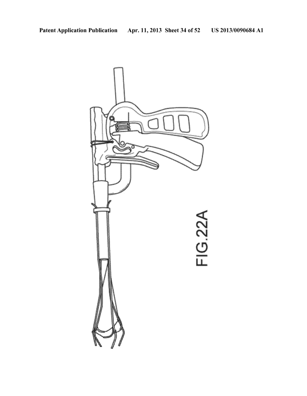 TRANS-CATHETER VENTRICULAR RECONSTRUCTION STRUCTURES, METHODS, AND SYSTEMS     FOR TREATMENT OF CONGESTIVE HEART FAILURE AND OTHER CONDITIONS - diagram, schematic, and image 35