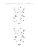 METHODS AND SYSTEMS FOR TISSUE FASTENING diagram and image