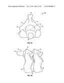 POSTERIOR VERTEBRAL PLATING SYSTEM diagram and image