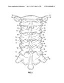 POSTERIOR VERTEBRAL PLATING SYSTEM diagram and image