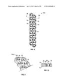 POSTERIOR VERTEBRAL PLATING SYSTEM diagram and image