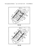 POSTERIOR VERTEBRAL PLATING SYSTEM diagram and image