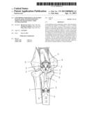 LOW PROFILE PERIARTICULAR TENSION BAND PLATING SYSTEM WITH SOFT TISSUE     NEUTRALIZATION CABLE TUNNEL/CHANNEL diagram and image