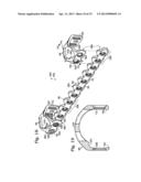 BONE FIXATION SYSTEM WITH OPPOSED MOUNTING PORTIONS diagram and image