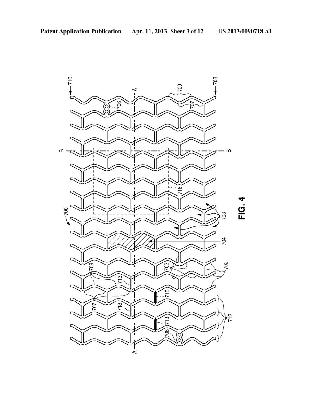 RADIALLY EXPANDABLE POLYMER PROSTHESIS AND METHOD OF MAKING SAME - diagram, schematic, and image 04