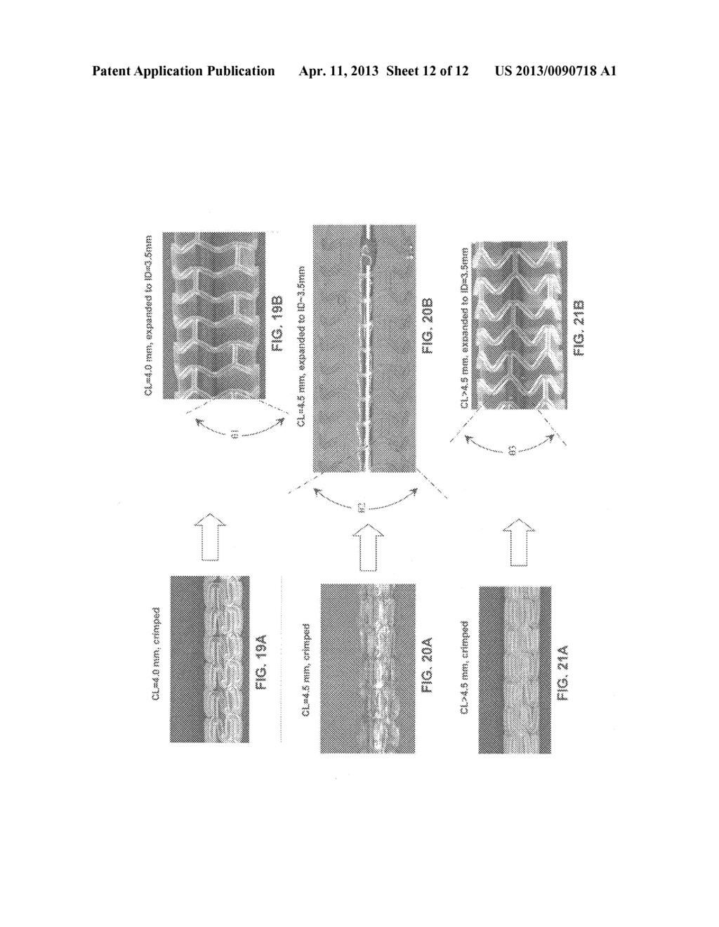 RADIALLY EXPANDABLE POLYMER PROSTHESIS AND METHOD OF MAKING SAME - diagram, schematic, and image 13