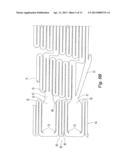 Highly Flexible Stent and Method of Manufacture diagram and image