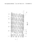 Highly Flexible Stent and Method of Manufacture diagram and image