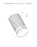 Highly Flexible Stent and Method of Manufacture diagram and image