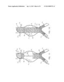 MULTI-COMPONENT BIFURCATED STENT-GRAFT SYSTEMS diagram and image