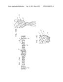 MULTI-COMPONENT BIFURCATED STENT-GRAFT SYSTEMS diagram and image