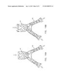 MULTI-COMPONENT BIFURCATED STENT-GRAFT SYSTEMS diagram and image