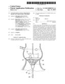 UNITARY QUICK-CONNECT PROSTHETIC HEART VALVE DEPLOYMENT METHODS diagram and image