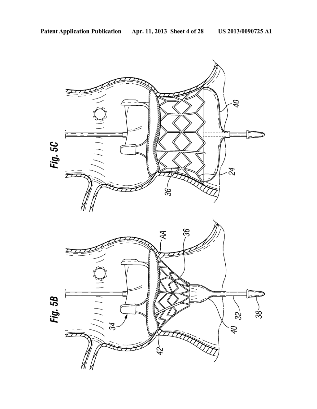 UNITARY QUICK-CONNECT PROSTHETIC HEART VALVE DEPLOYMENT METHODS - diagram, schematic, and image 05