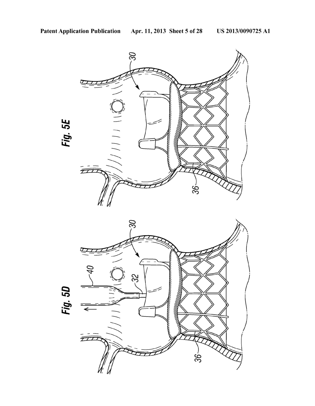 UNITARY QUICK-CONNECT PROSTHETIC HEART VALVE DEPLOYMENT METHODS - diagram, schematic, and image 06
