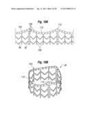 UNITARY QUICK-CONNECT PROSTHETIC HEART VALVE DEPLOYMENT METHODS diagram and image