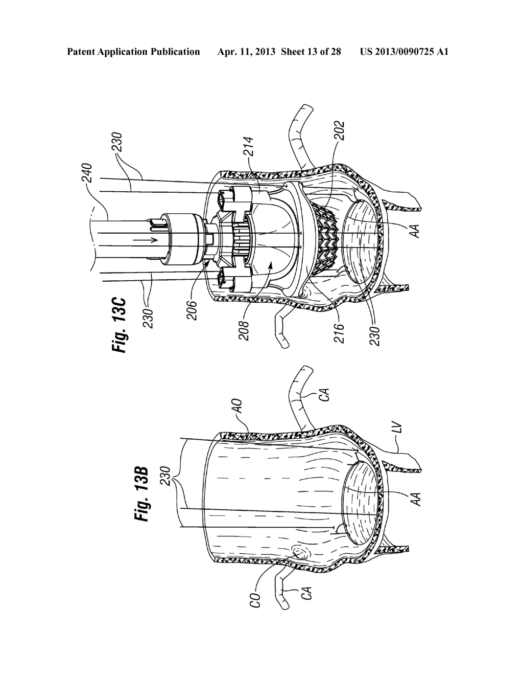 UNITARY QUICK-CONNECT PROSTHETIC HEART VALVE DEPLOYMENT METHODS - diagram, schematic, and image 14