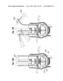 UNITARY QUICK-CONNECT PROSTHETIC HEART VALVE DEPLOYMENT METHODS diagram and image