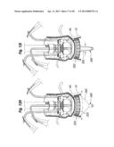 UNITARY QUICK-CONNECT PROSTHETIC HEART VALVE DEPLOYMENT METHODS diagram and image