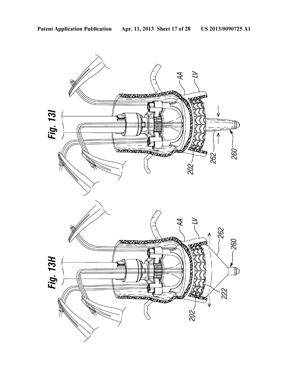 UNITARY QUICK-CONNECT PROSTHETIC HEART VALVE DEPLOYMENT METHODS - diagram, schematic, and image 18