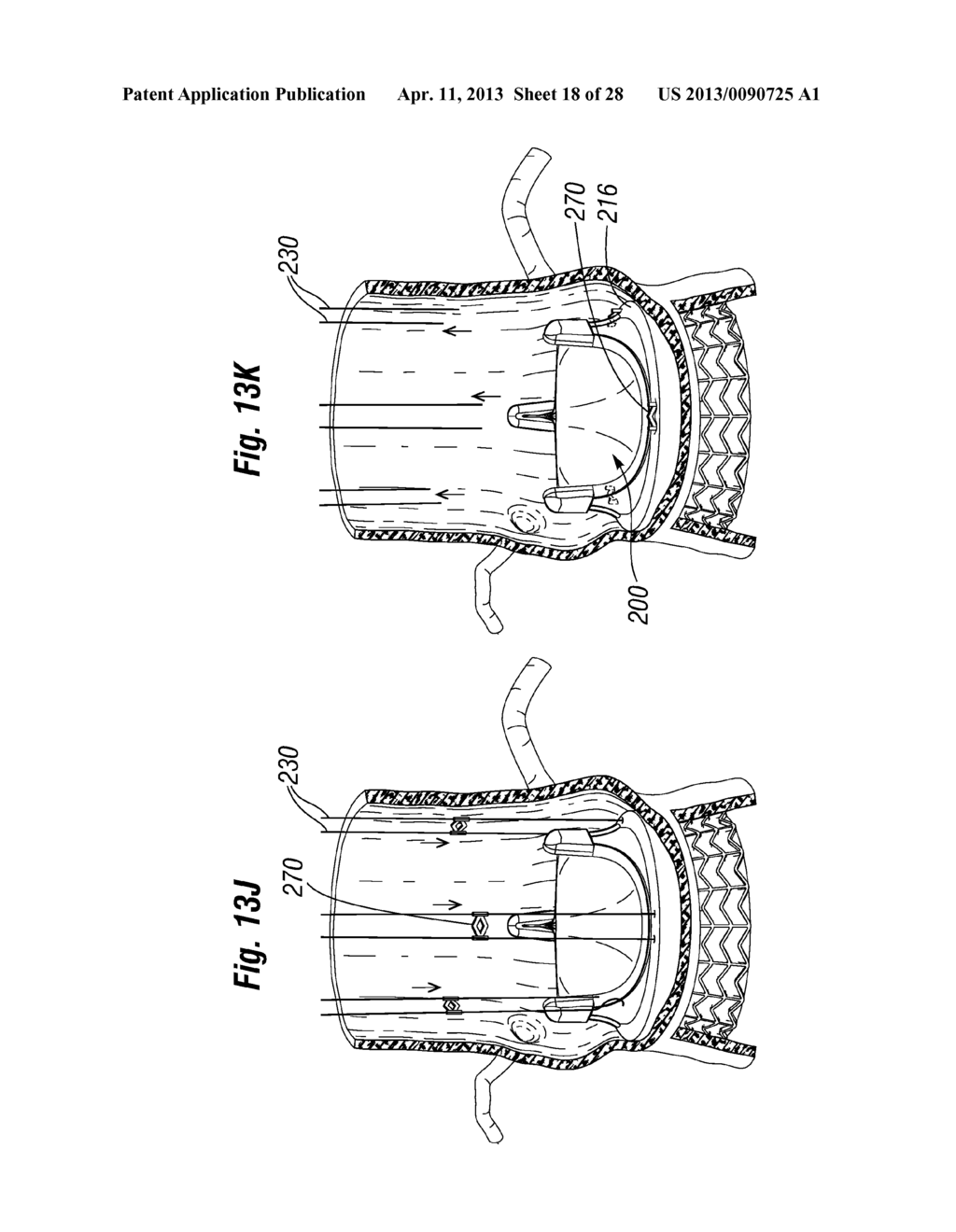 UNITARY QUICK-CONNECT PROSTHETIC HEART VALVE DEPLOYMENT METHODS - diagram, schematic, and image 19