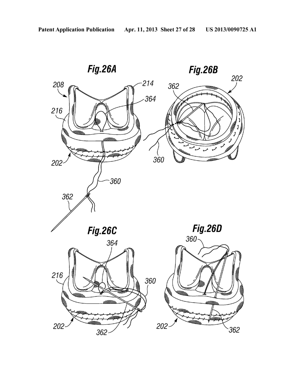 UNITARY QUICK-CONNECT PROSTHETIC HEART VALVE DEPLOYMENT METHODS - diagram, schematic, and image 28