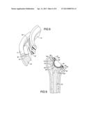 Multiple Bearing Humeral Prosthesis diagram and image