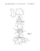 IMPLANTABLE WRIST JOINT ASSEMBLY WITH SPHERICAL INTER-SUPPORT diagram and image