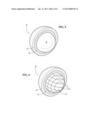 IMPLANTABLE WRIST JOINT ASSEMBLY WITH SPHERICAL INTER-SUPPORT diagram and image