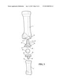 IMPLANTABLE HALLUX JOINT ASSEMBLY WITH SPHERICAL INTER-SUPPORT diagram and image