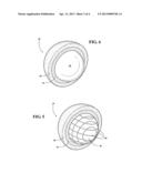 IMPLANTABLE HALLUX JOINT ASSEMBLY WITH SPHERICAL INTER-SUPPORT diagram and image