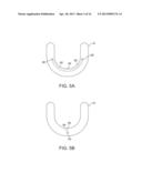 AUTOMATED TISSUE RETENTION SYSTEM diagram and image