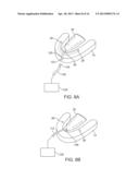 AUTOMATED TISSUE RETENTION SYSTEM diagram and image