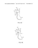 AUTOMATED TISSUE RETENTION SYSTEM diagram and image