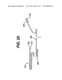 Surgical wound closure device diagram and image