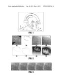 NON-RIGID 2D/3D REGISTRATION OF CORONARY ARTERY MODELS WITH LIVE     FLUOROSCOPY IMAGES diagram and image