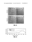 NON-RIGID 2D/3D REGISTRATION OF CORONARY ARTERY MODELS WITH LIVE     FLUOROSCOPY IMAGES diagram and image