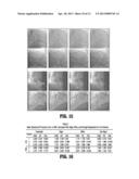 NON-RIGID 2D/3D REGISTRATION OF CORONARY ARTERY MODELS WITH LIVE     FLUOROSCOPY IMAGES diagram and image