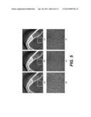 NOISE SUPPRESSION IN CONE BEAM CT PROJECTION DATA diagram and image