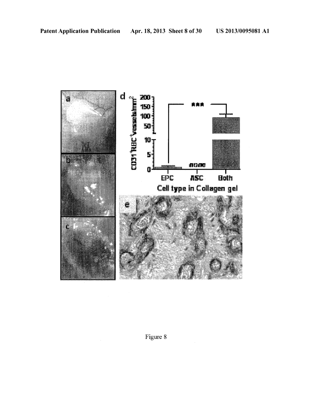 COMPOSITIONS AND METHODS OF TREATMENT WITH STEM CELLS - diagram, schematic, and image 09