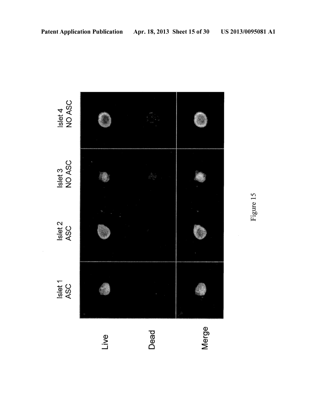 COMPOSITIONS AND METHODS OF TREATMENT WITH STEM CELLS - diagram, schematic, and image 16