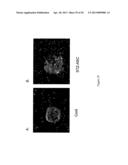 COMPOSITIONS AND METHODS OF TREATMENT WITH STEM CELLS diagram and image