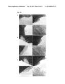 BIOMATERIAL FROM WHARTON S JELLY UMBILICAL CORD diagram and image