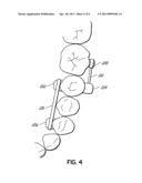 Direct Manufacture of Orthodontic Aligner Appliance diagram and image