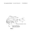 Direct Manufacture of Orthodontic Aligner Appliance diagram and image