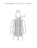 EXERCISE APPARATUS AND APPAREL diagram and image