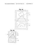 SYSTEM AND METHOD FOR NAVIGATING AN ULTRASOUND CATHETER TO IMAGE A BEATING     HEART diagram and image