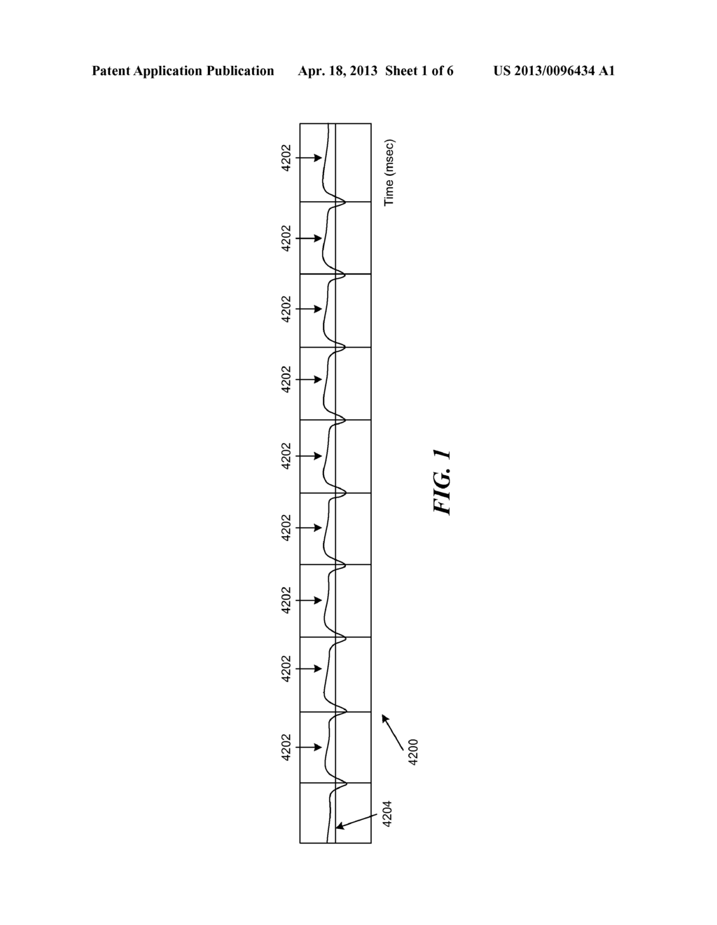 METHODS FOR ACQUISITION AND DISPLAY IN ULTRASOUND IMAGING - diagram, schematic, and image 02