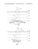 SYSTEMS AND METHODS FOR TREATING  INJURIES TO JOINTS AND CONNECTIVE TISSUE diagram and image